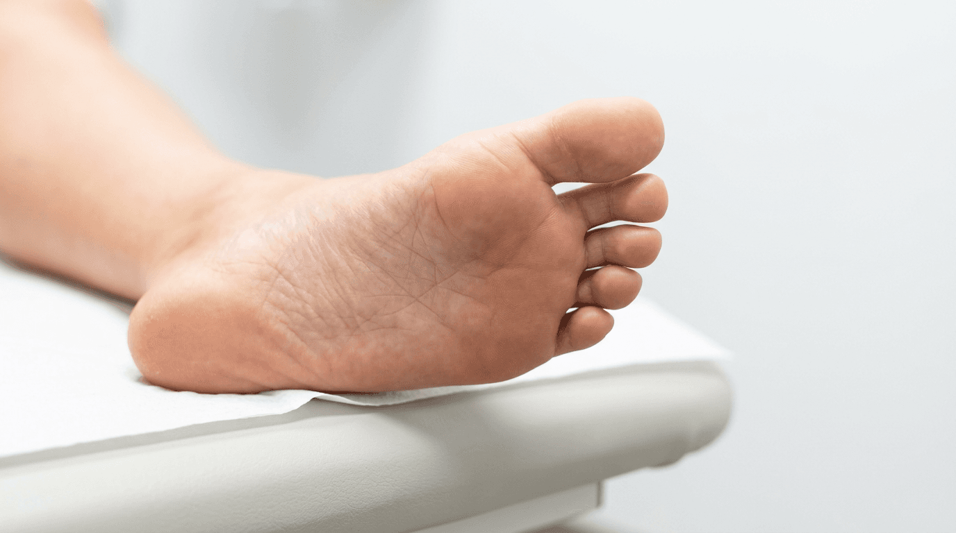 Affections dermatologiques du pied