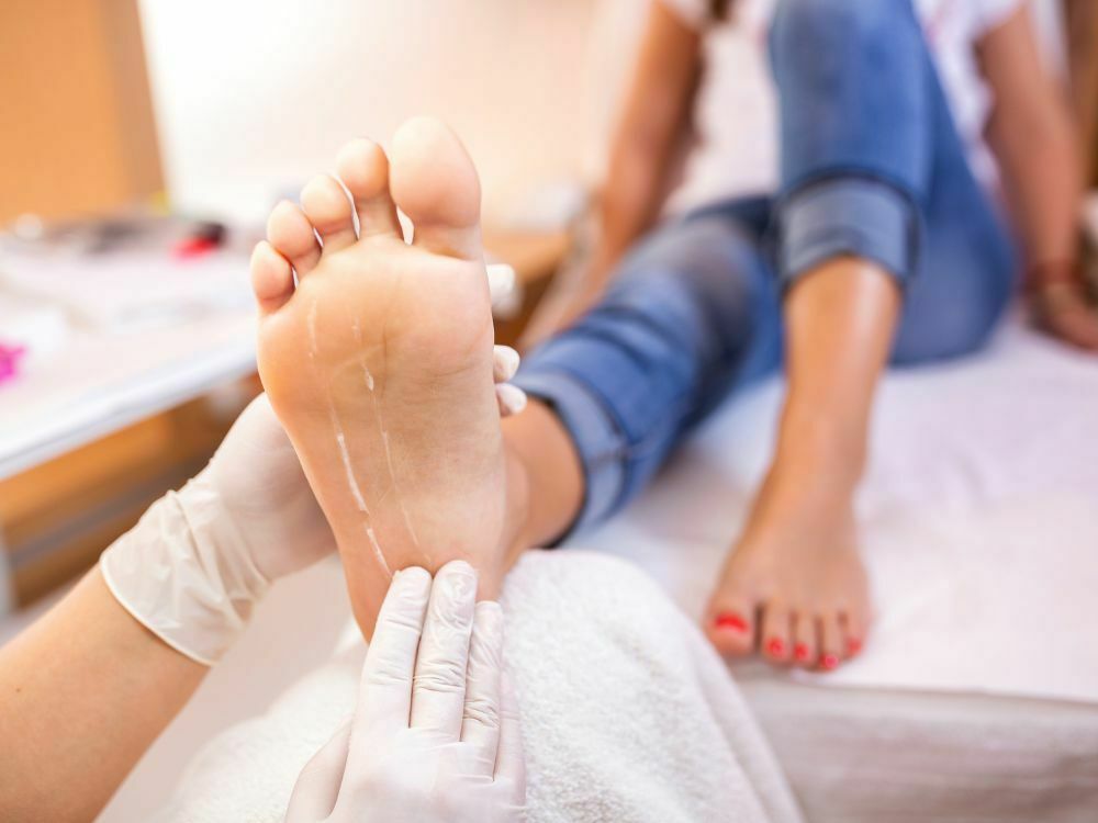 Un podiatre expérimenté traite un pied affecté par le pied d'athlète avec des soins professionnels et des médicaments antifongiques.